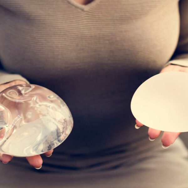 The Lifespan of Breast Implants